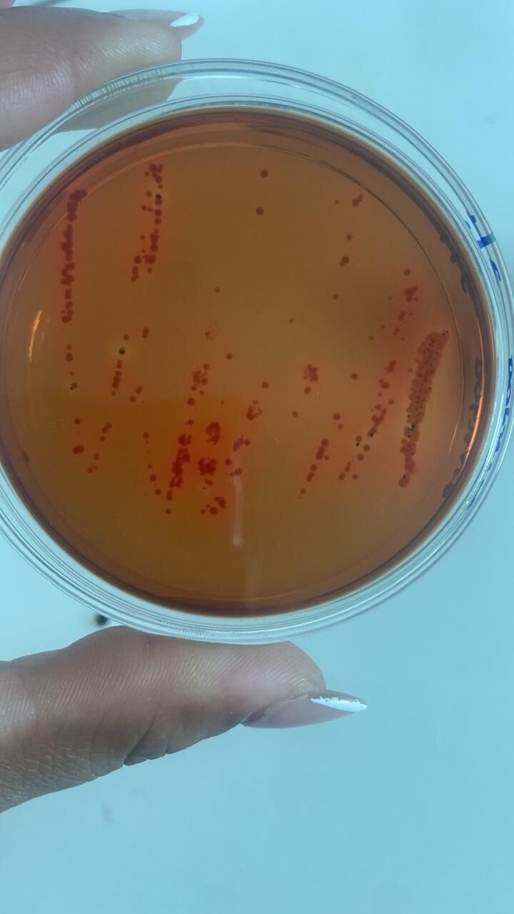 Placa de Petri com colônias em análise microbiológica